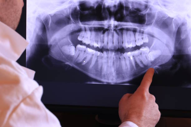 Best Emergency Treatment for Oral Infections in Redan, GA